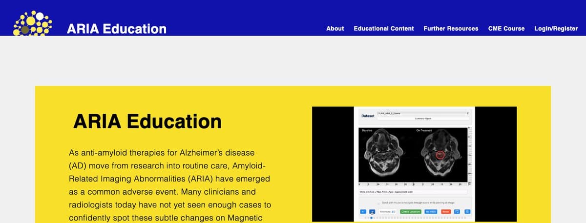 Screenshot of the ARIAEducation.eu home page, with an interactive MRI case viewer