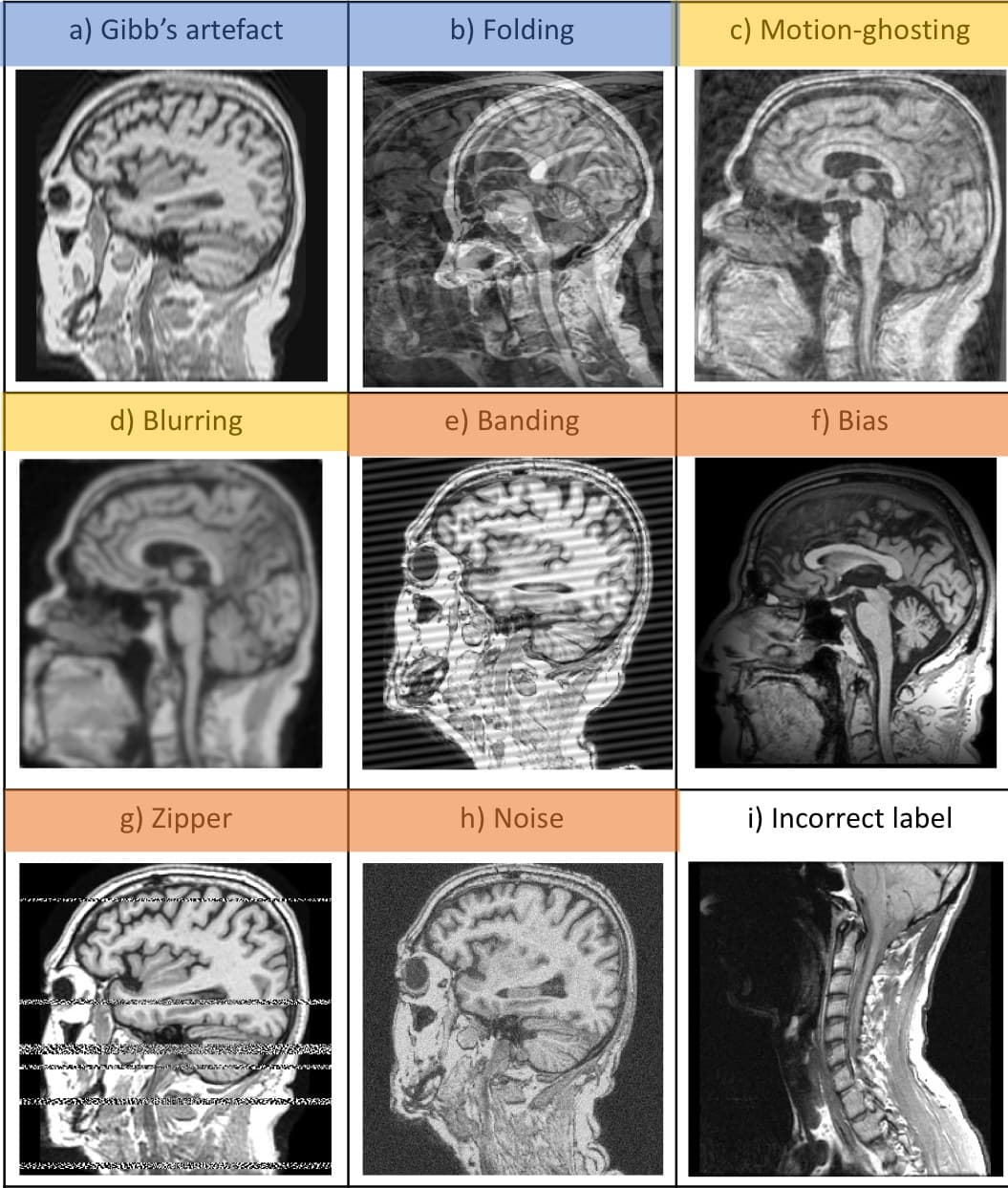 Grid of sagittal brain MRI slices, each showing one artefact type